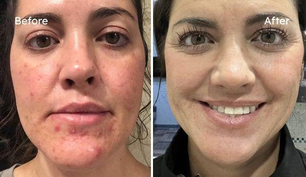 Kimberly transformation