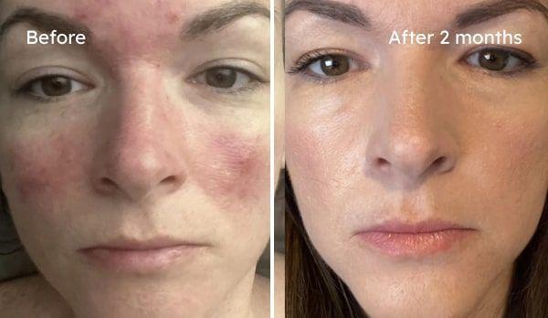 Kelly transformation