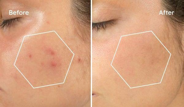 Tonianne transformation